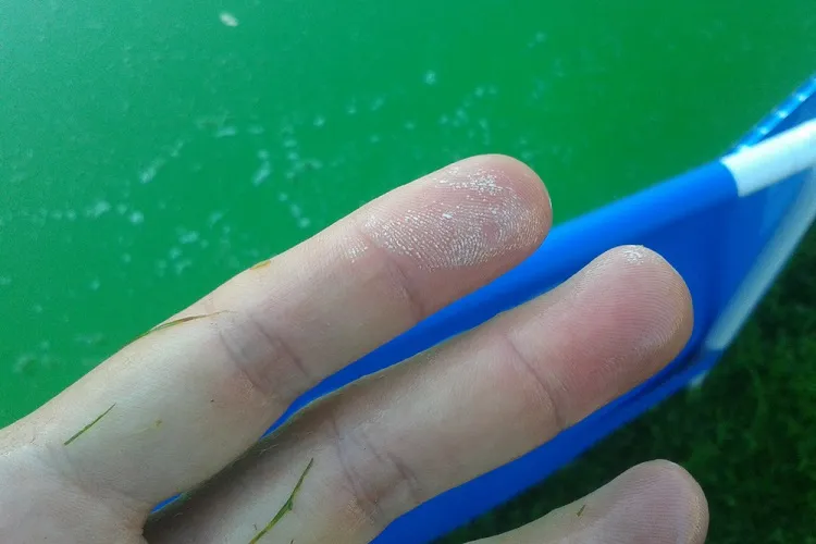 Руки после чистки бассейна