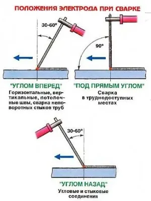 Положения электрода